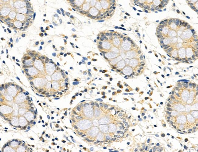 CD44 Antibody in Immunohistochemistry (Paraffin) (IHC (P))