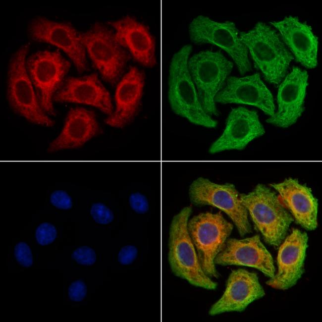 CD64 Antibody in Immunocytochemistry (ICC/IF)