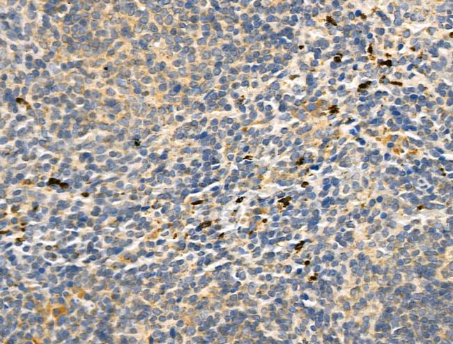 CD83 Antibody in Immunohistochemistry (Paraffin) (IHC (P))