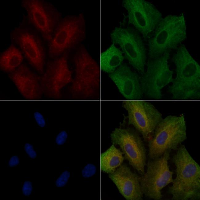 CD86 Antibody in Immunocytochemistry (ICC/IF)