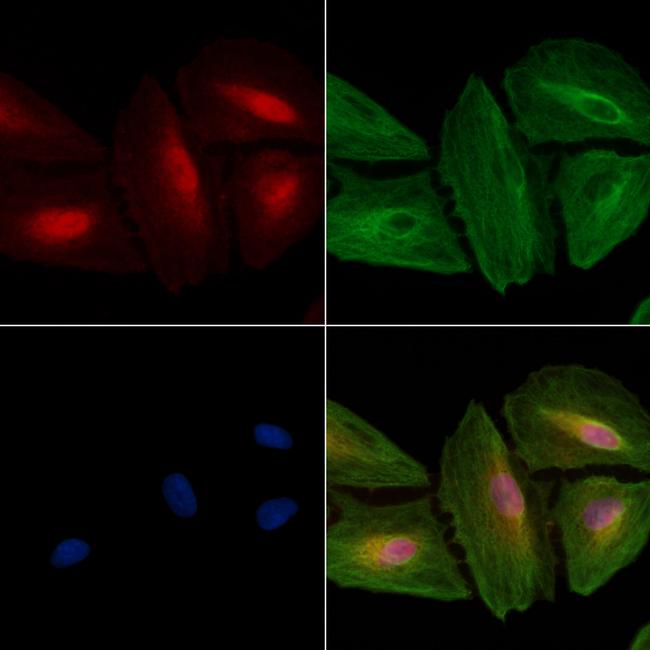 CDK5RAP3 Antibody in Immunocytochemistry (ICC/IF)