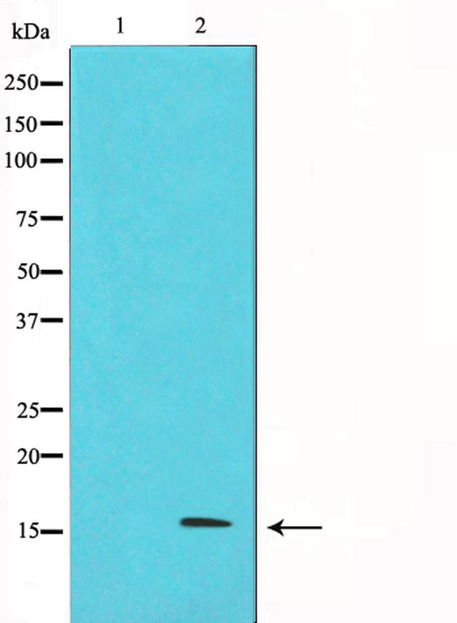 p16INK4a Antibody in Western Blot (WB)