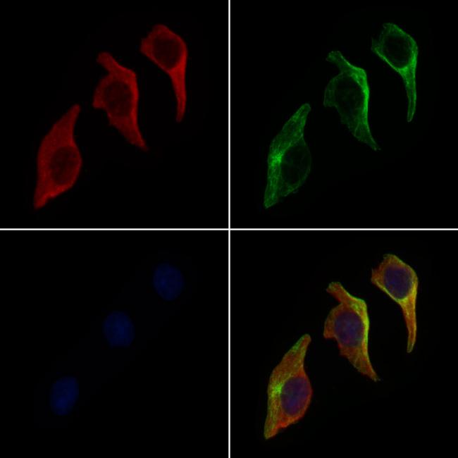 CEL Antibody in Immunocytochemistry (ICC/IF)