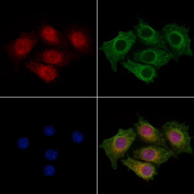 CENPB Antibody in Immunocytochemistry (ICC/IF)