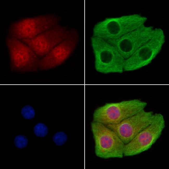 CHD4 Antibody in Immunocytochemistry (ICC/IF)