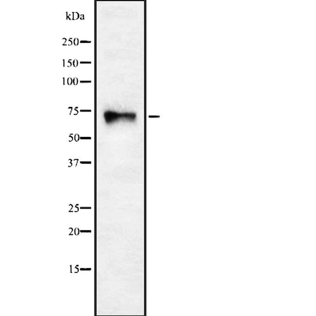 CHRNA4 Antibody in Western Blot (WB)