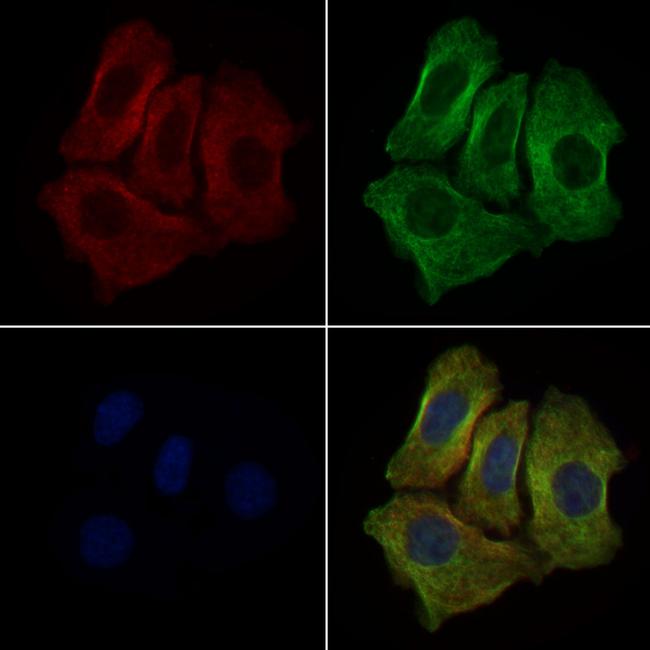 CLCN2 Antibody in Immunocytochemistry (ICC/IF)