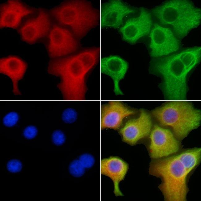 CLIC4 Antibody in Immunocytochemistry (ICC/IF)