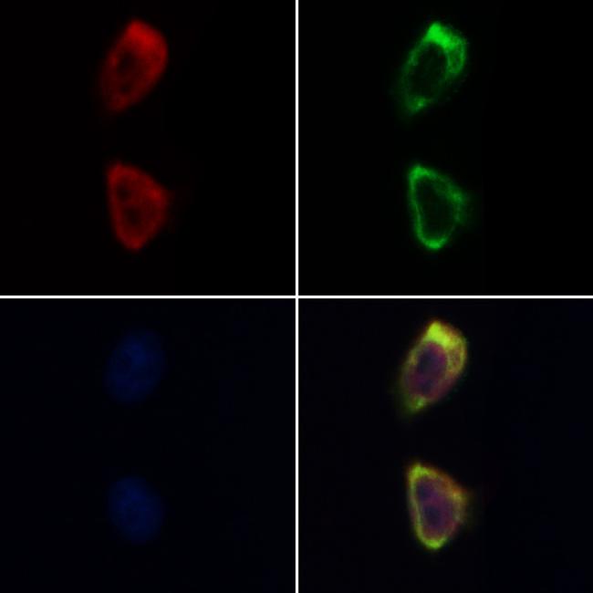 Cofilin 1/2 Antibody in Immunocytochemistry (ICC/IF)