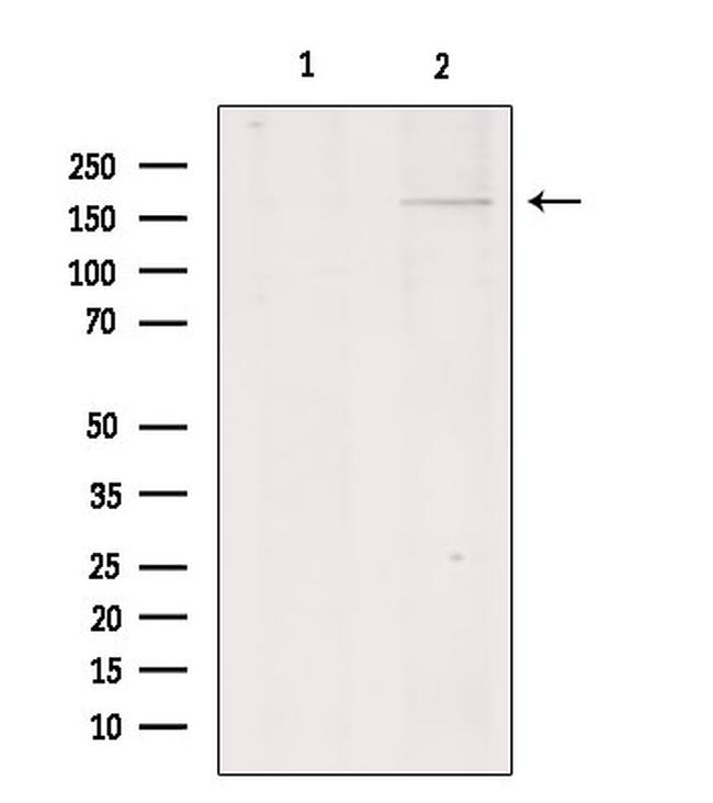 COL11A1 Antibody in Western Blot (WB)