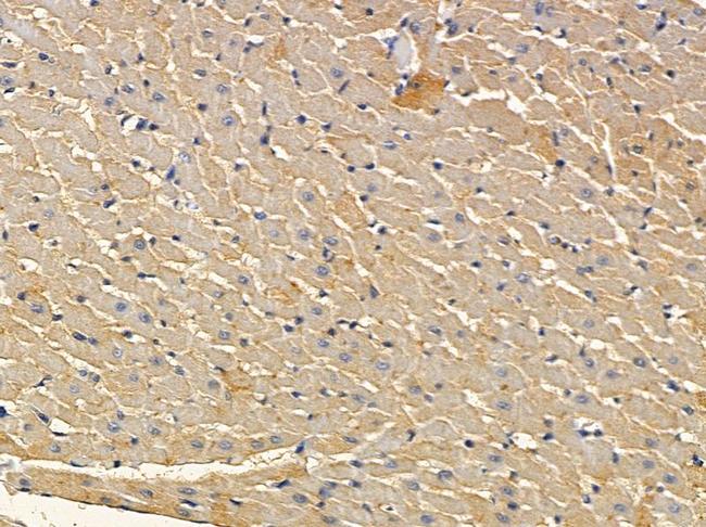 CSF2RB Antibody in Immunohistochemistry (Paraffin) (IHC (P))