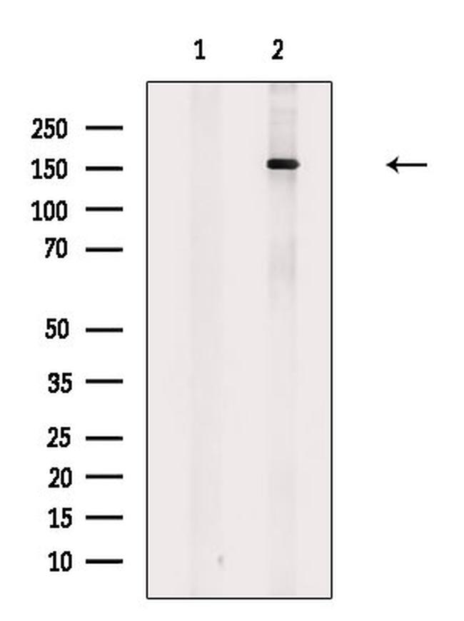 CUX1 Antibody in Western Blot (WB)