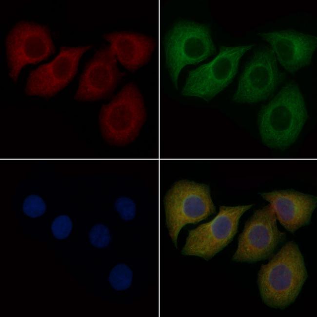 PPBP Antibody in Immunocytochemistry (ICC/IF)