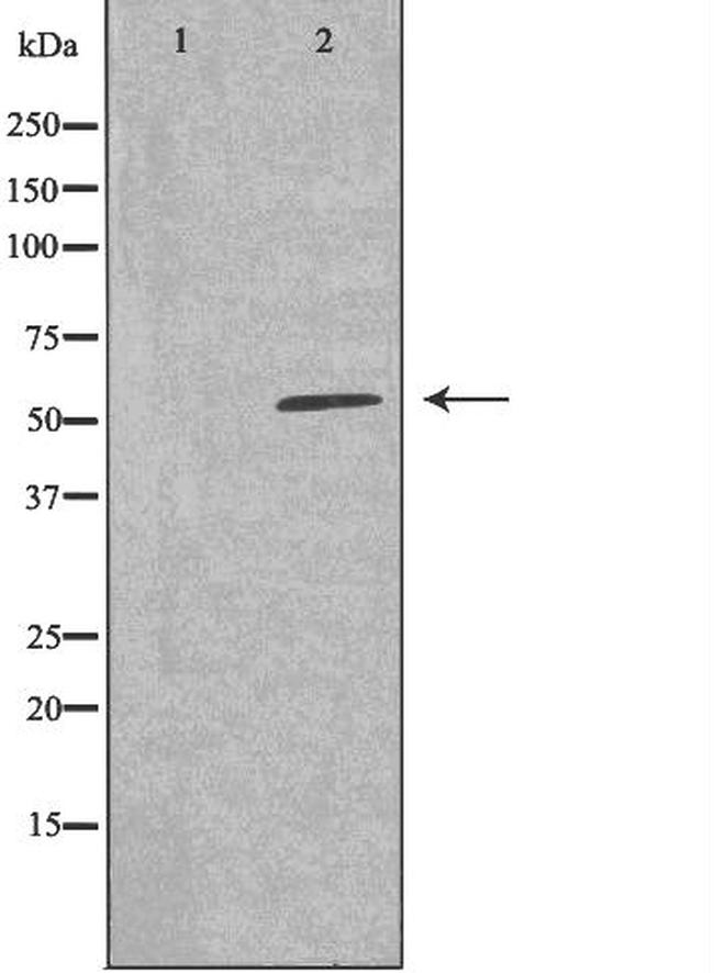 CYP26A1 Antibody in Western Blot (WB)