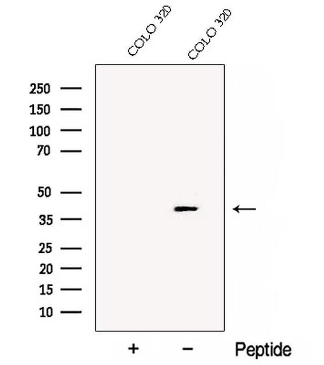 DDAH2 Antibody in Western Blot (WB)