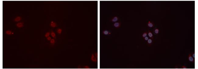 DDB1 Antibody in Immunocytochemistry (ICC/IF)