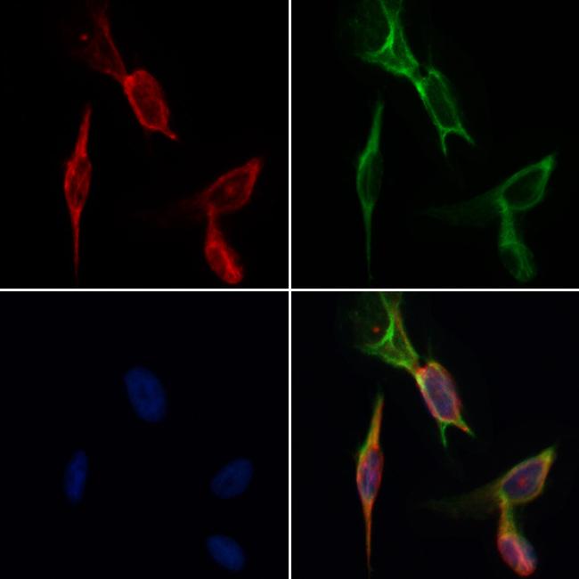 Desmin Antibody in Immunocytochemistry (ICC/IF)