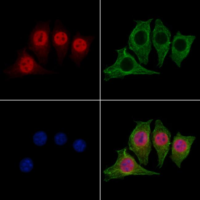 DFFB Antibody in Immunocytochemistry (ICC/IF)