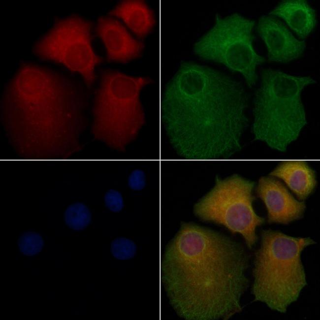 DHFR Antibody in Immunocytochemistry (ICC/IF)