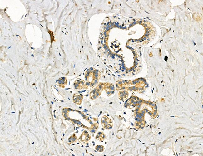 Dicer Antibody in Immunohistochemistry (Paraffin) (IHC (P))