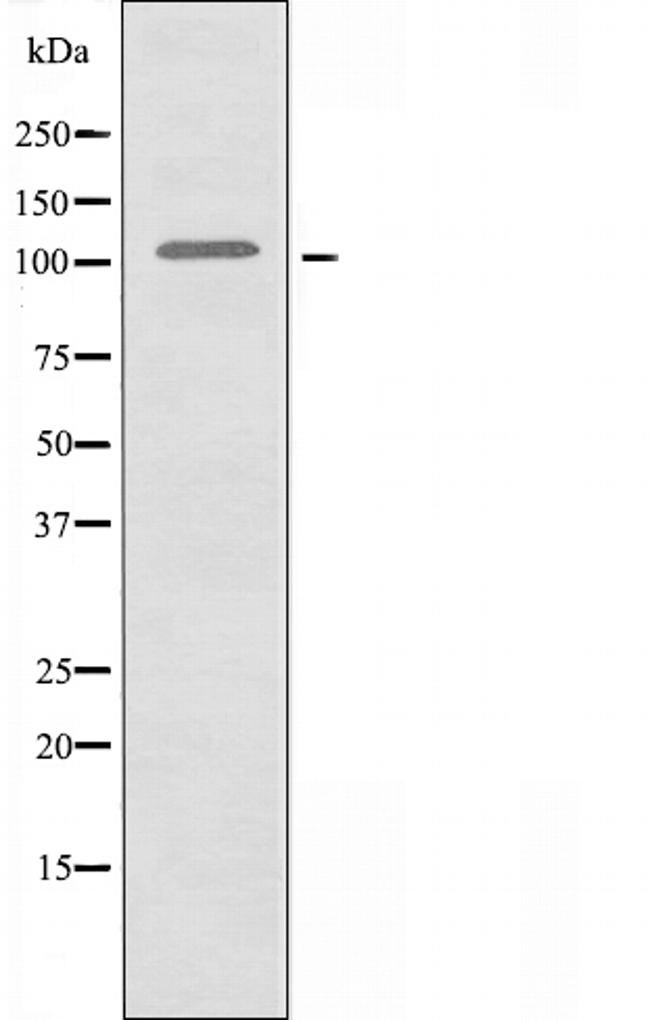 DNA Ligase IV Antibody in Western Blot (WB)