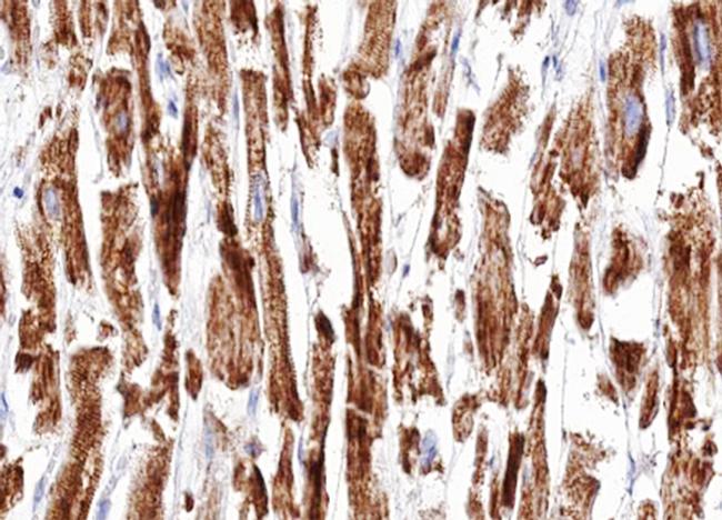 DOK7 Antibody in Immunohistochemistry (Paraffin) (IHC (P))