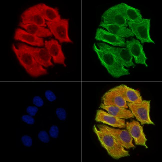 DPP9 Antibody in Immunocytochemistry (ICC/IF)