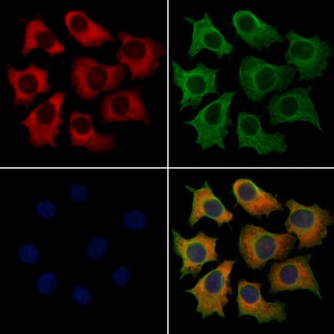 DTX4 Antibody in Immunocytochemistry (ICC/IF)