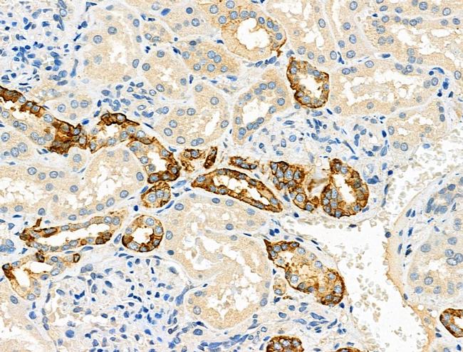 DVL3 Antibody in Immunohistochemistry (Paraffin) (IHC (P))