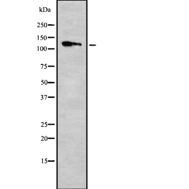 KIF11 Antibody in Western Blot (WB)