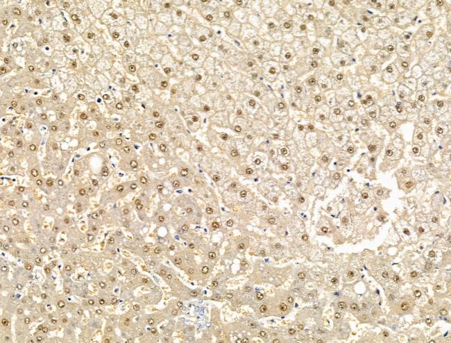 EIF4ENIF1 Antibody in Immunohistochemistry (Paraffin) (IHC (P))