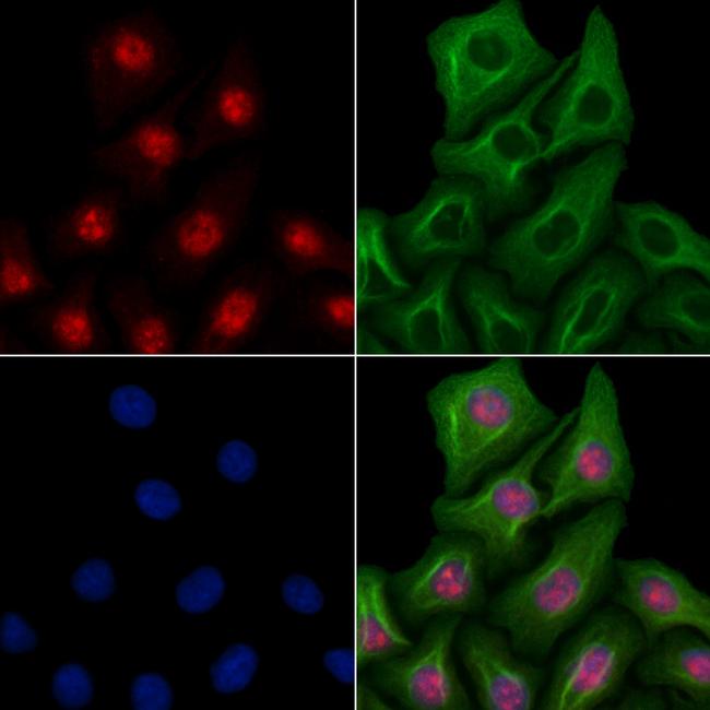 ELOA Antibody in Immunocytochemistry (ICC/IF)