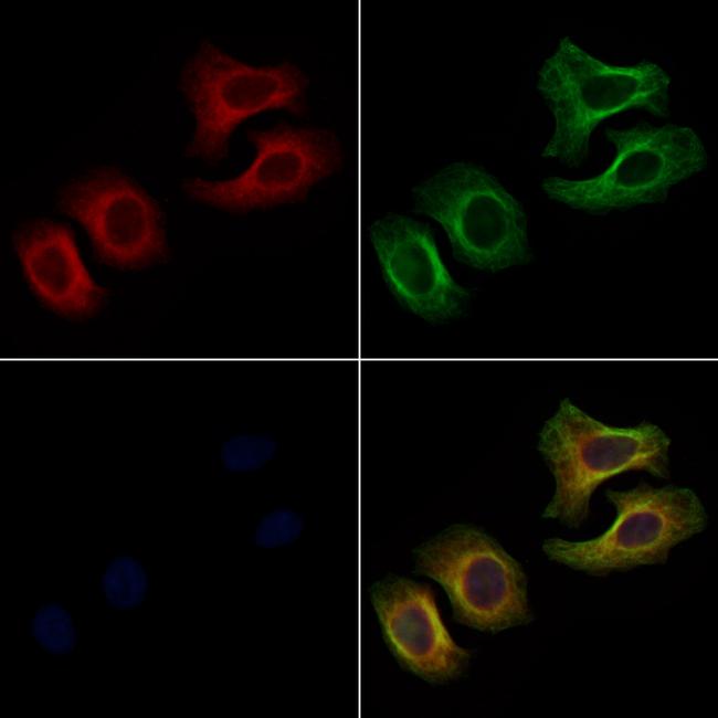 EPHA3 Antibody in Immunocytochemistry (ICC/IF)