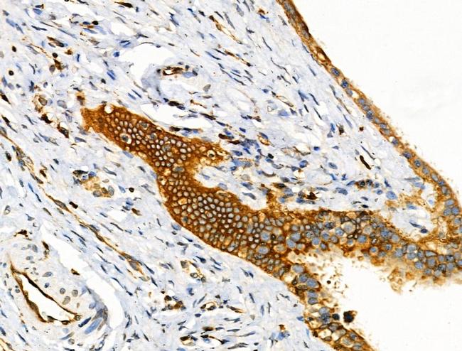 EphB4 Antibody in Immunohistochemistry (Paraffin) (IHC (P))