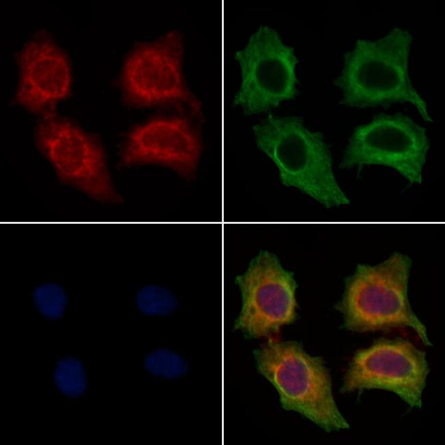 FCER1G Antibody in Immunocytochemistry (ICC/IF)