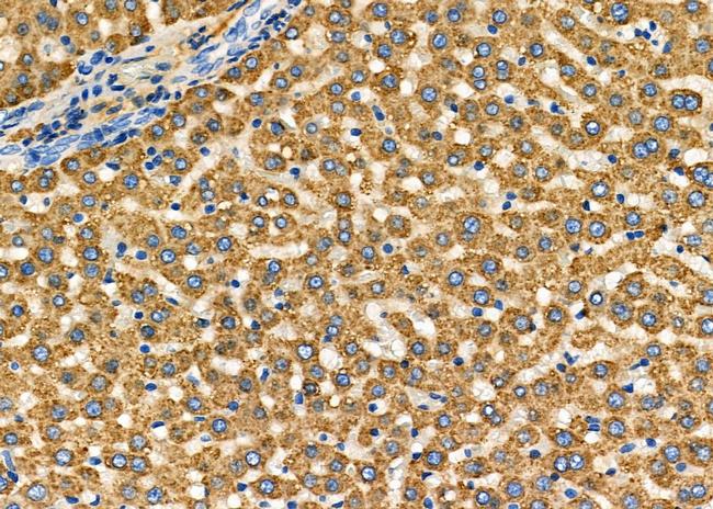 Fibrinogen Antibody in Immunohistochemistry (Paraffin) (IHC (P))