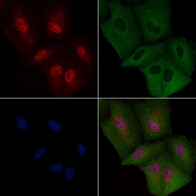 FGF1 Antibody in Immunocytochemistry (ICC/IF)