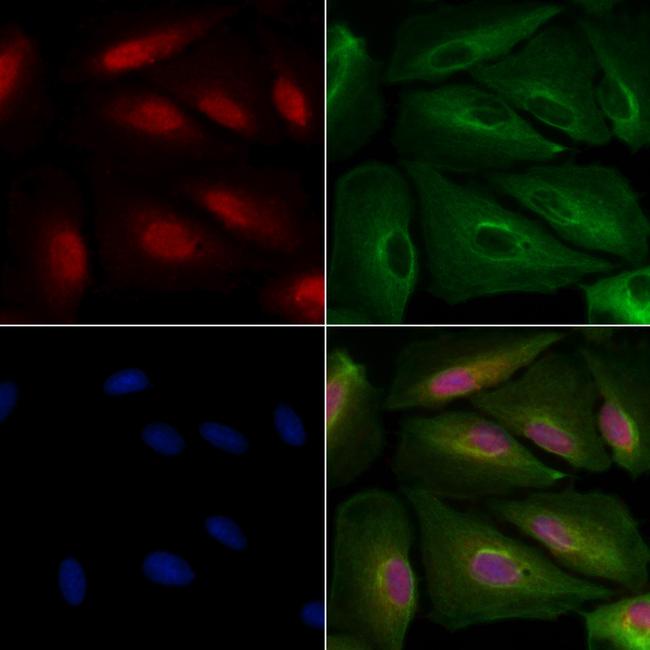 FOXA1 Antibody in Immunocytochemistry (ICC/IF)