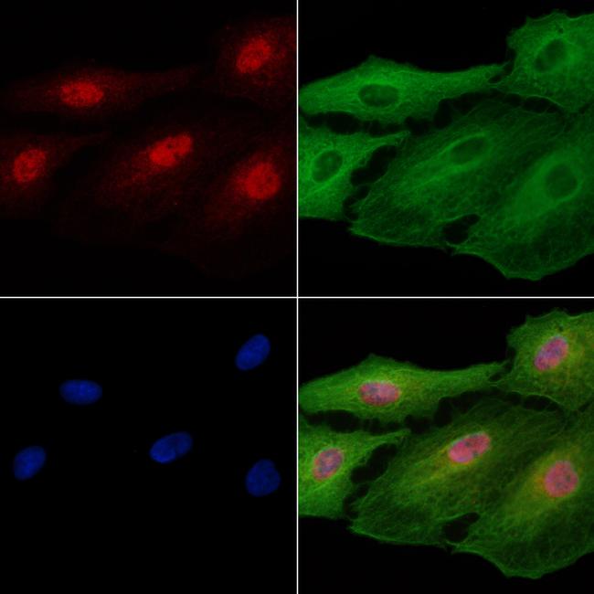 FOXF2 Antibody in Immunocytochemistry (ICC/IF)