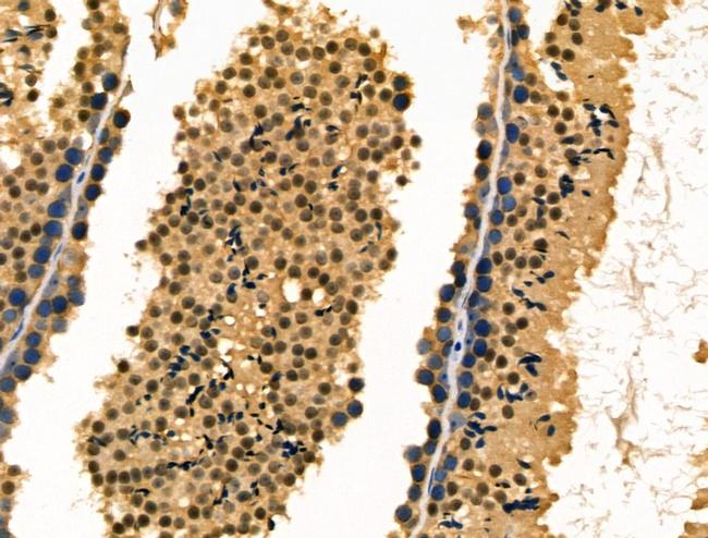 Fra1 Antibody in Immunohistochemistry (Paraffin) (IHC (P))