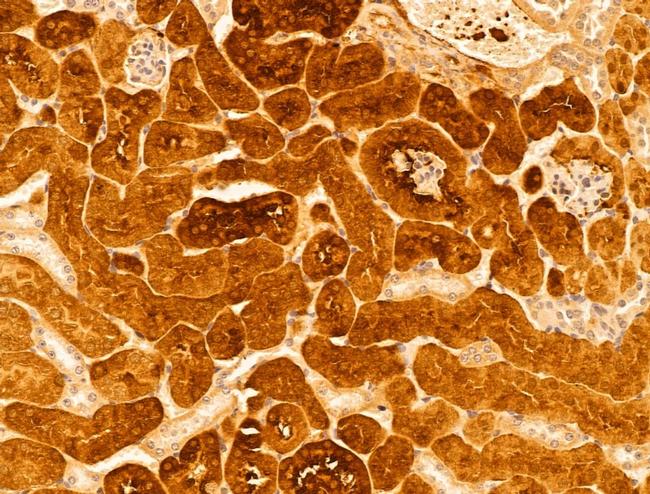 FTCD Antibody in Immunohistochemistry (Paraffin) (IHC (P))