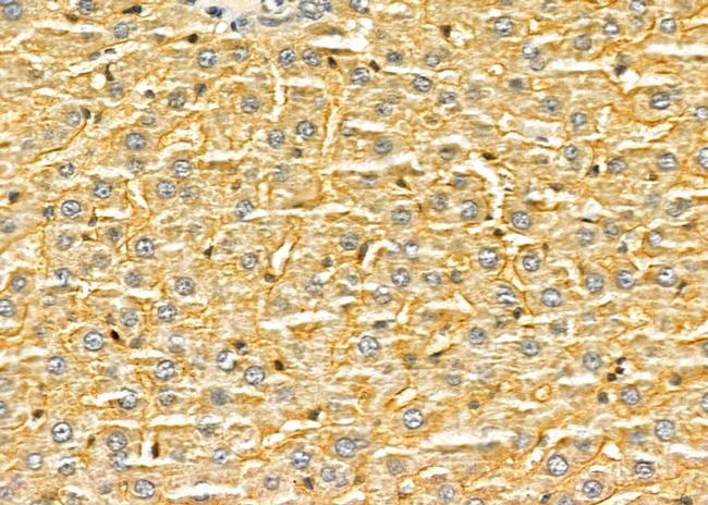 FZD1 Antibody in Immunohistochemistry (Paraffin) (IHC (P))