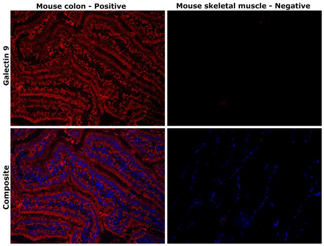 Galectin 9 Antibody in Immunohistochemistry (Paraffin) (IHC (P))