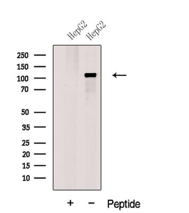 GART Antibody in Western Blot (WB)