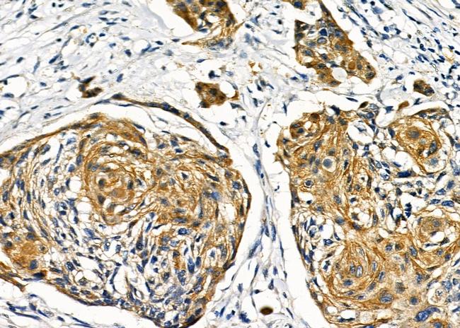 GCKR Antibody in Immunohistochemistry (Paraffin) (IHC (P))