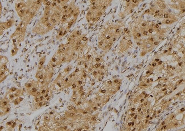 GLO1 Antibody in Immunohistochemistry (Paraffin) (IHC (P))