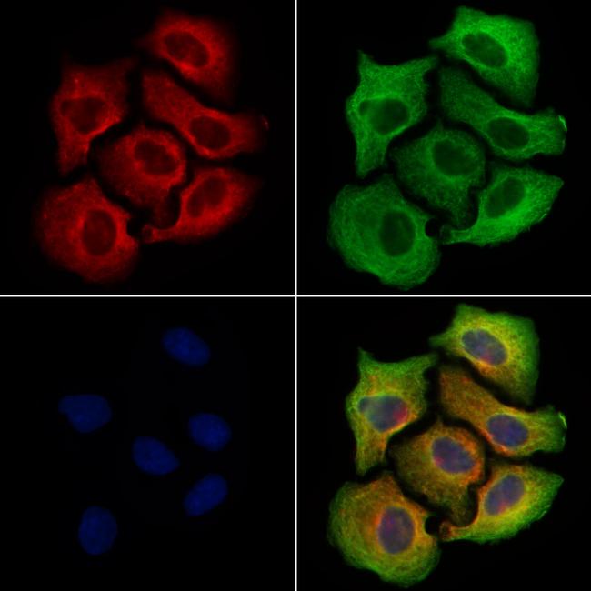 SLC2A12 Antibody in Immunocytochemistry (ICC/IF)