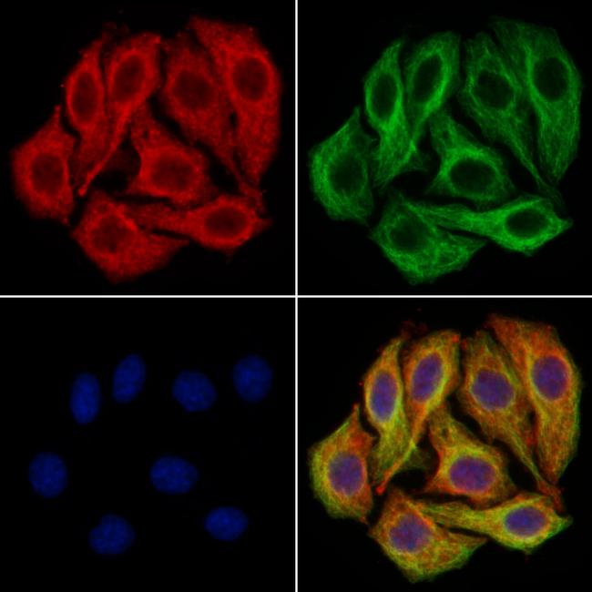 Glutaminase Antibody in Immunocytochemistry (ICC/IF)