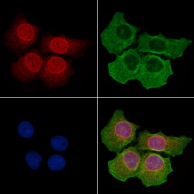 gp210 Antibody in Immunocytochemistry (ICC/IF)