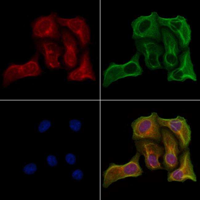 GPAT2 Antibody in Immunocytochemistry (ICC/IF)